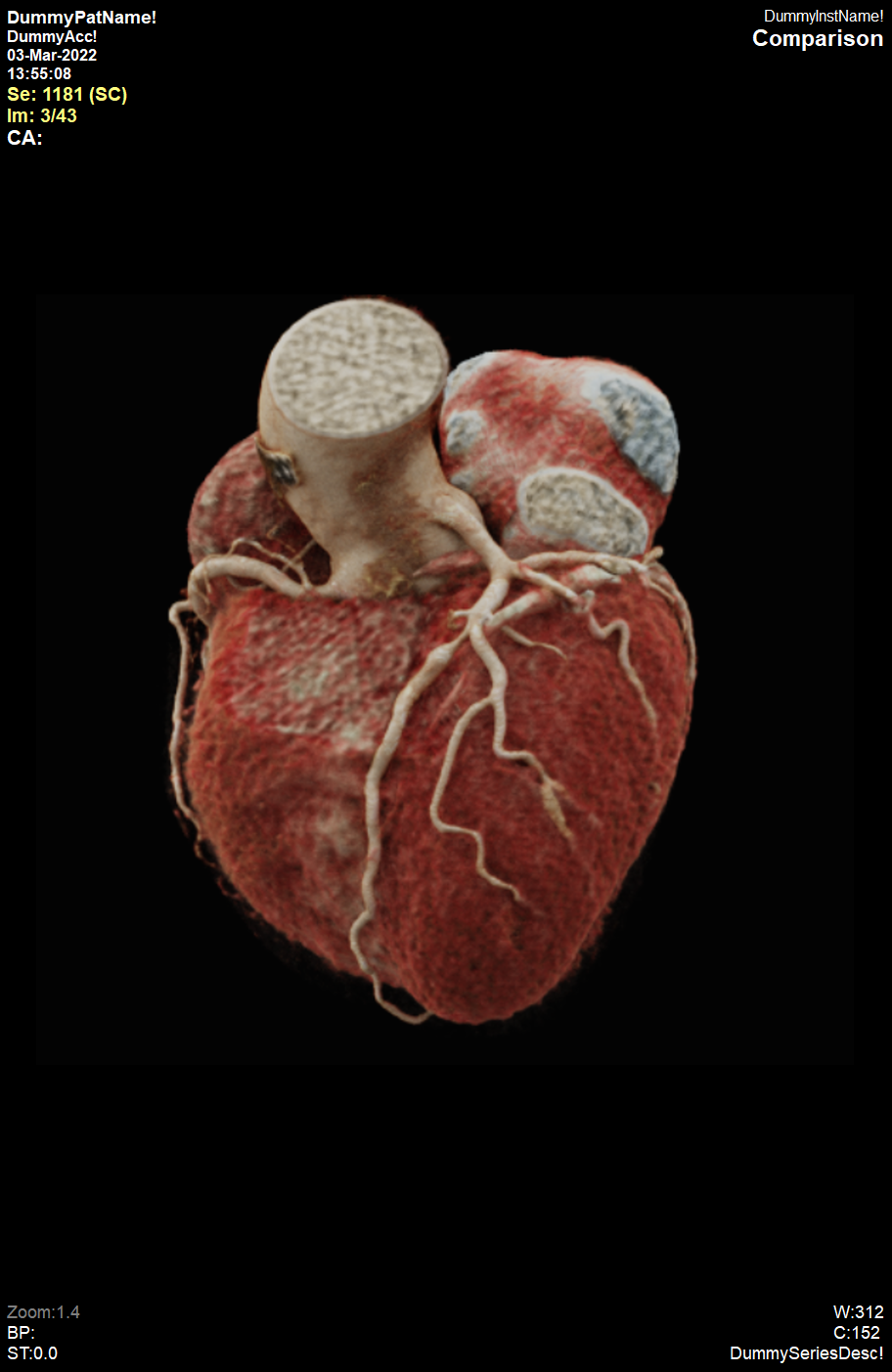 Estudios de imagen cardiovascular Pack 1: Dirección de Adquisición Remota