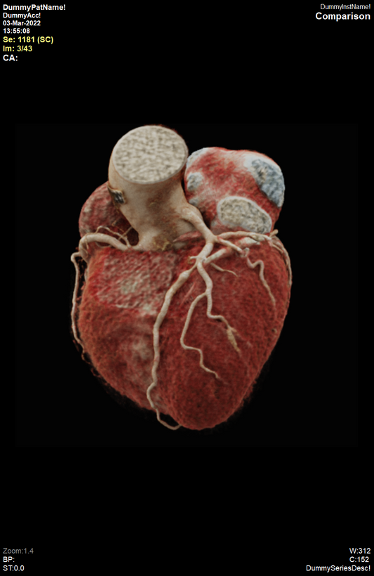 Estudios de imagen cardiovascular Pack 1: Dirección de Adquisición Remota