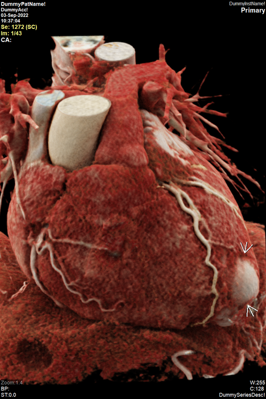 Estudios de imagen cardiovascular Pack 2: Dirección + Lectura Especializada