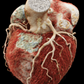 Estudios de imagen cardiovascular Pack3: Dirección + Lectura + Calidad y Capacitación