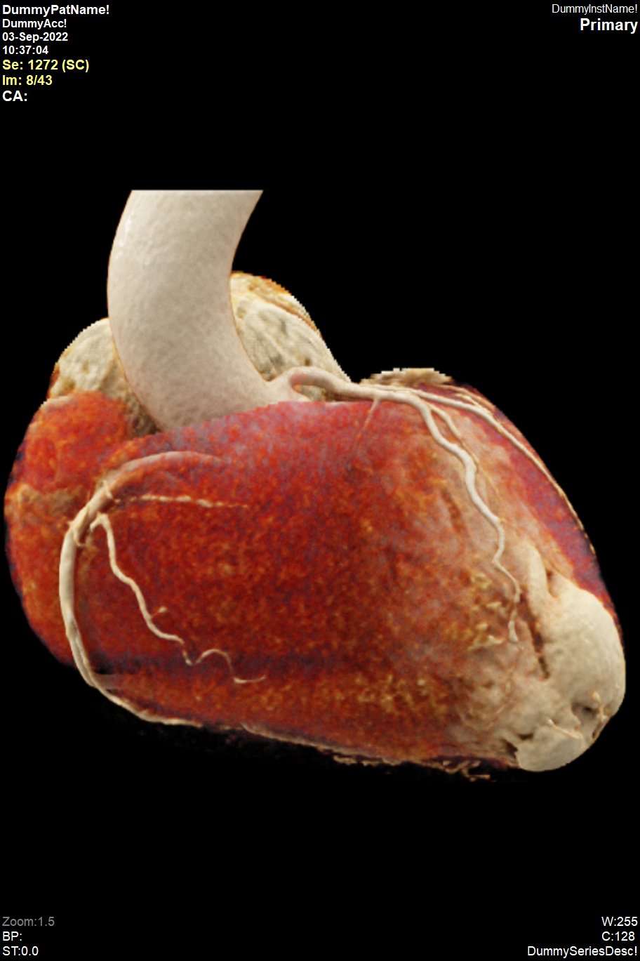 Estudios de imagen cardiovascular Pack 2: Dirección + Lectura Especializada